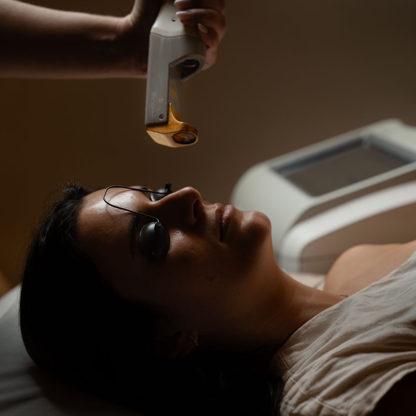 acné activo laser diodo para acne