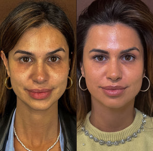 Full Face Inout / Refresh