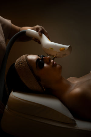 IPL + LÁSER RESURFX